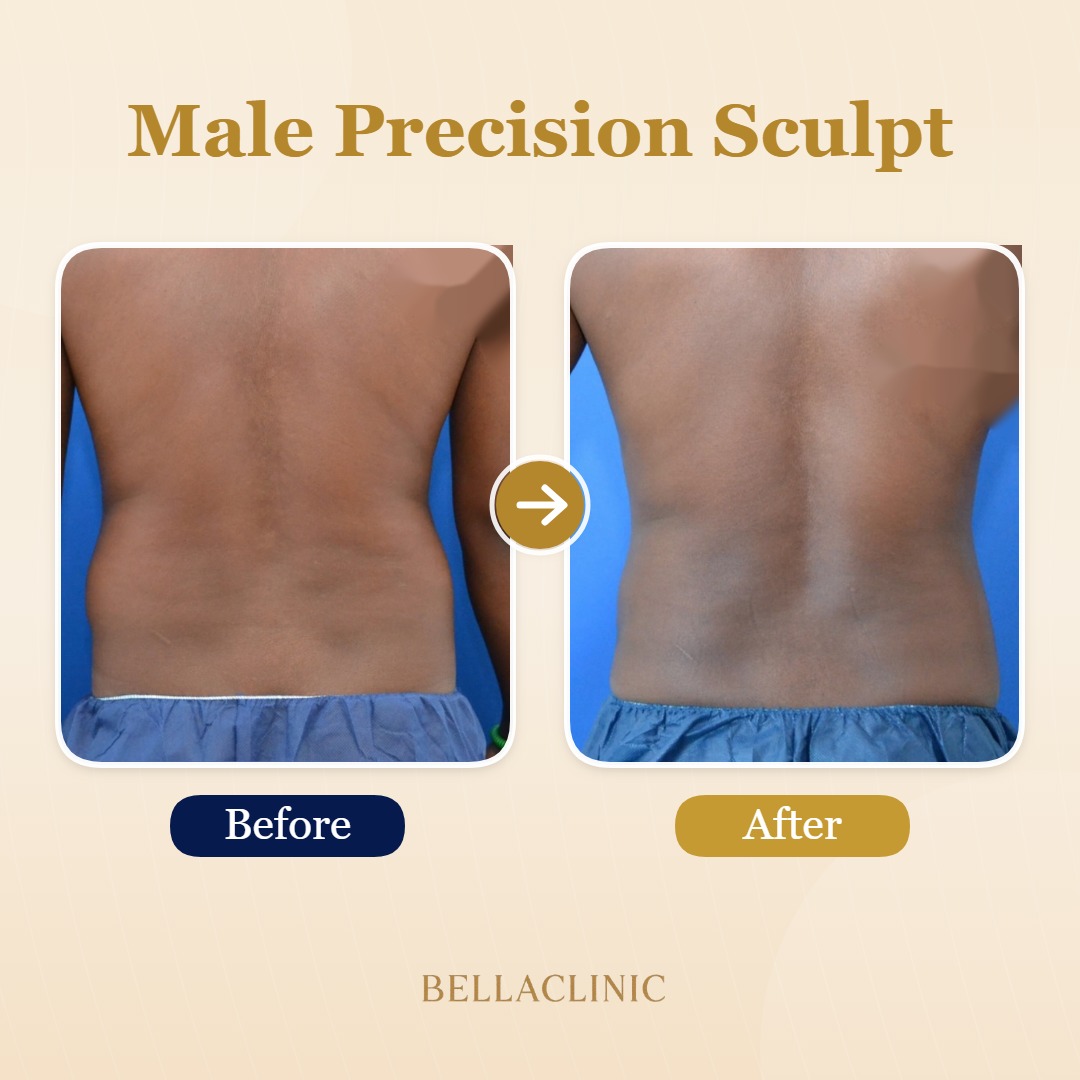 Male Precision Sculpt