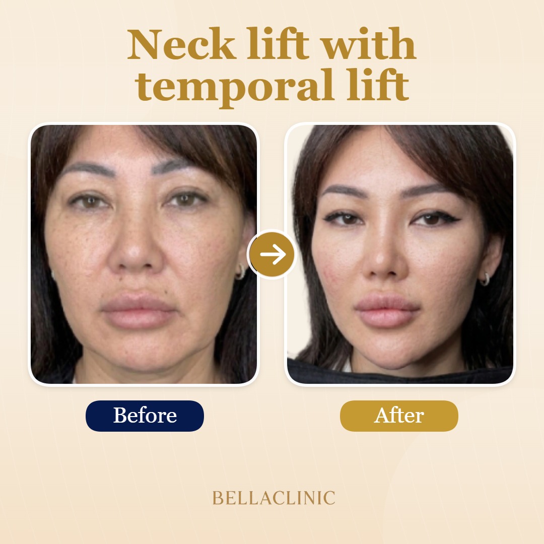before-after-20260720-171853-5wkw54.jpg