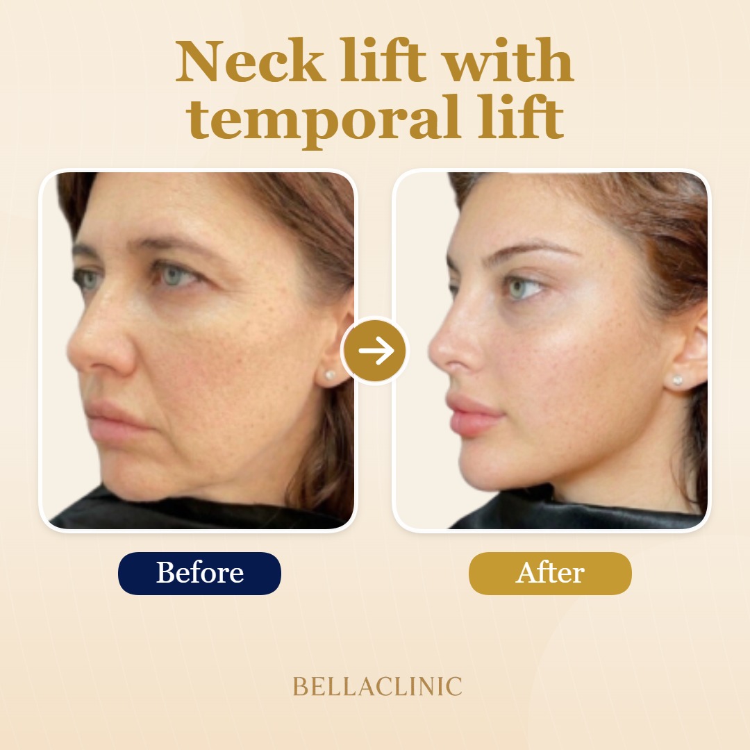 before-after-20260720-172223-jTujic.jpg