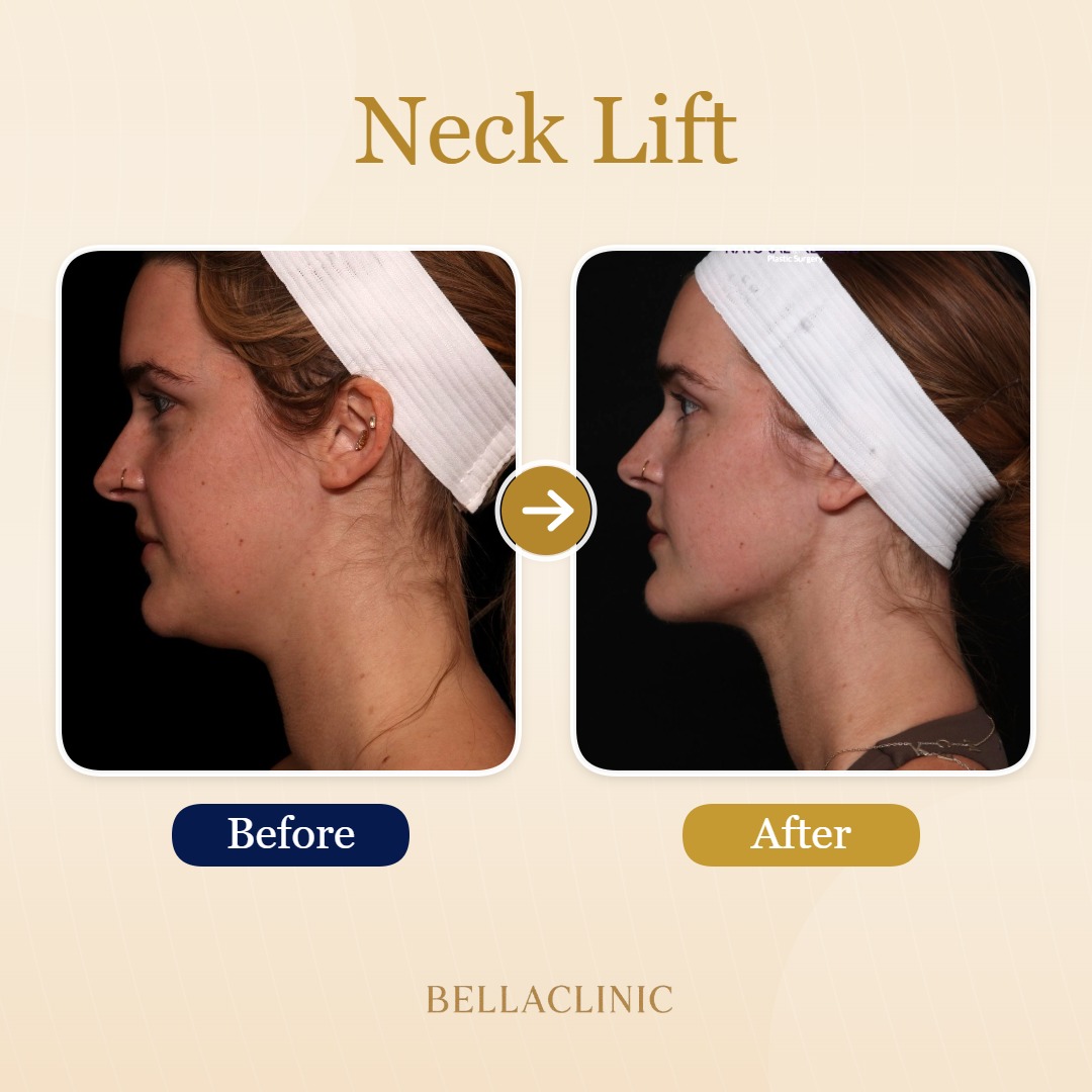 before-after-20260717-161310-nkOqIL.jpg
