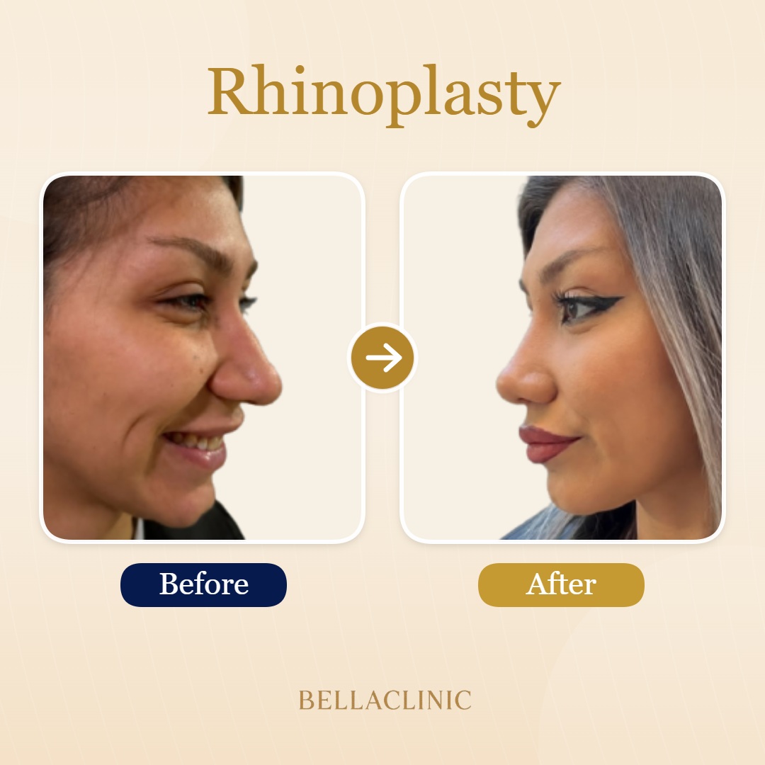 before-after-20260611-141832-Ulepyq.jpg