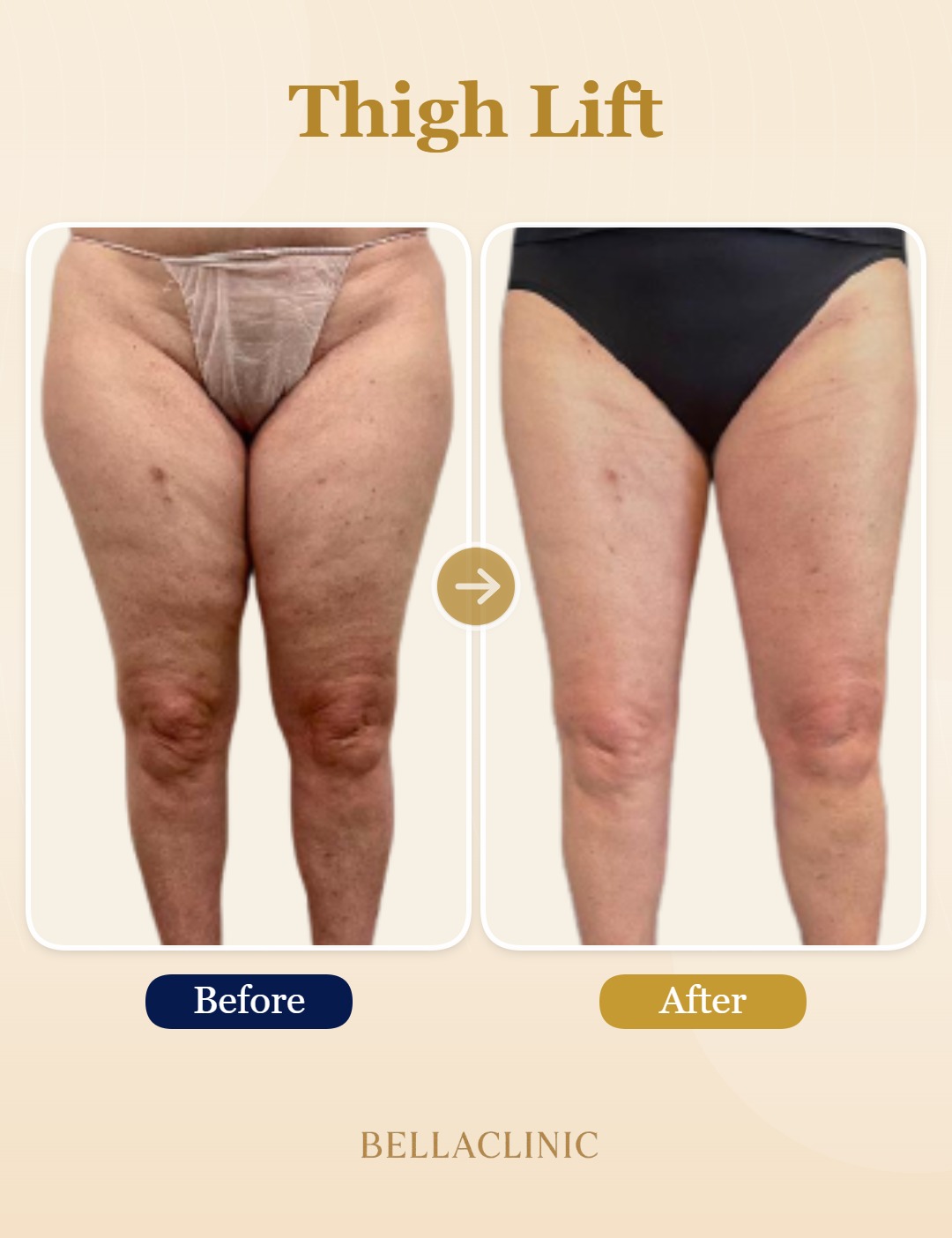 before-after-20260721-155641-s02m6b.jpg
