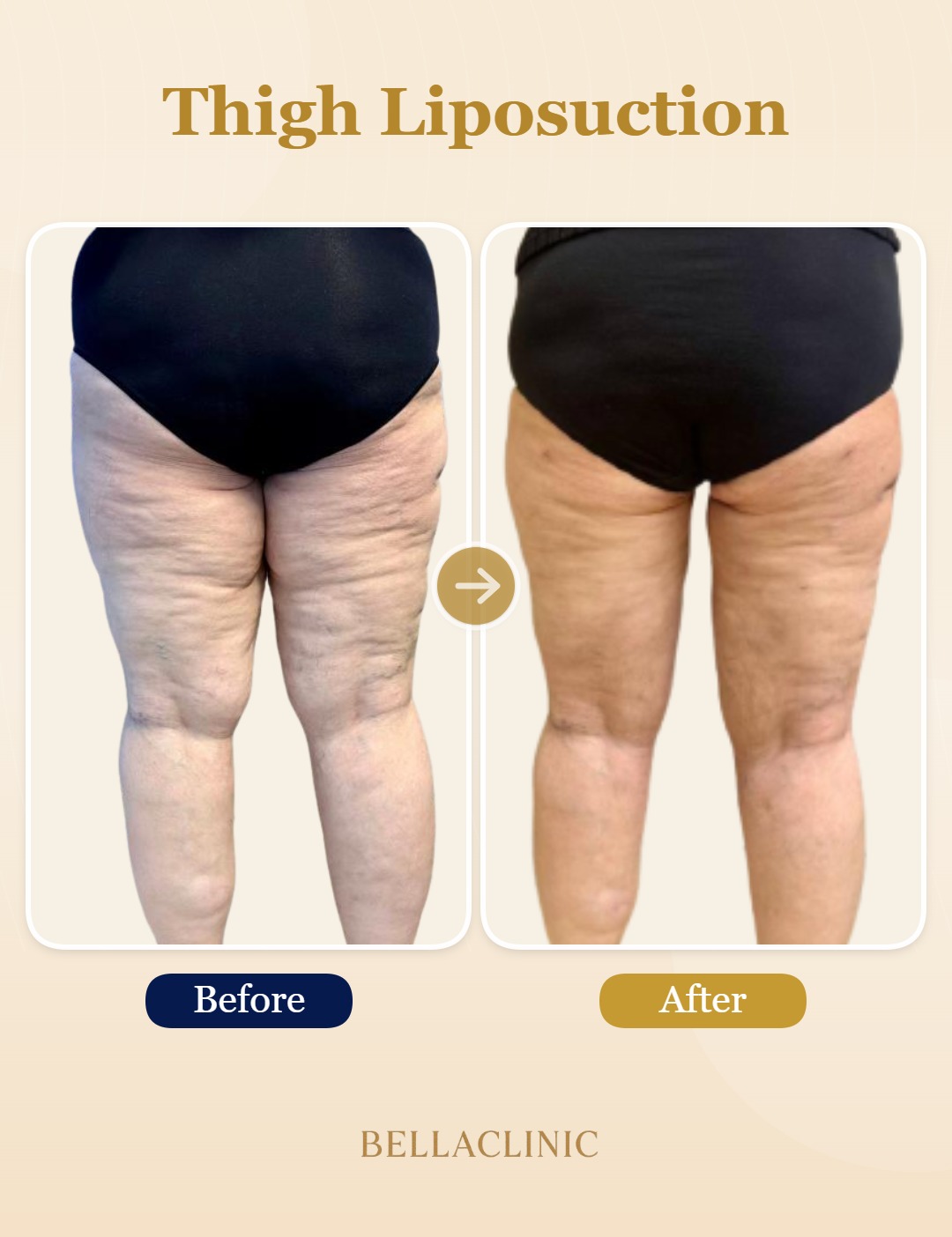 before-after-20260720-173530-h35V4X.jpg