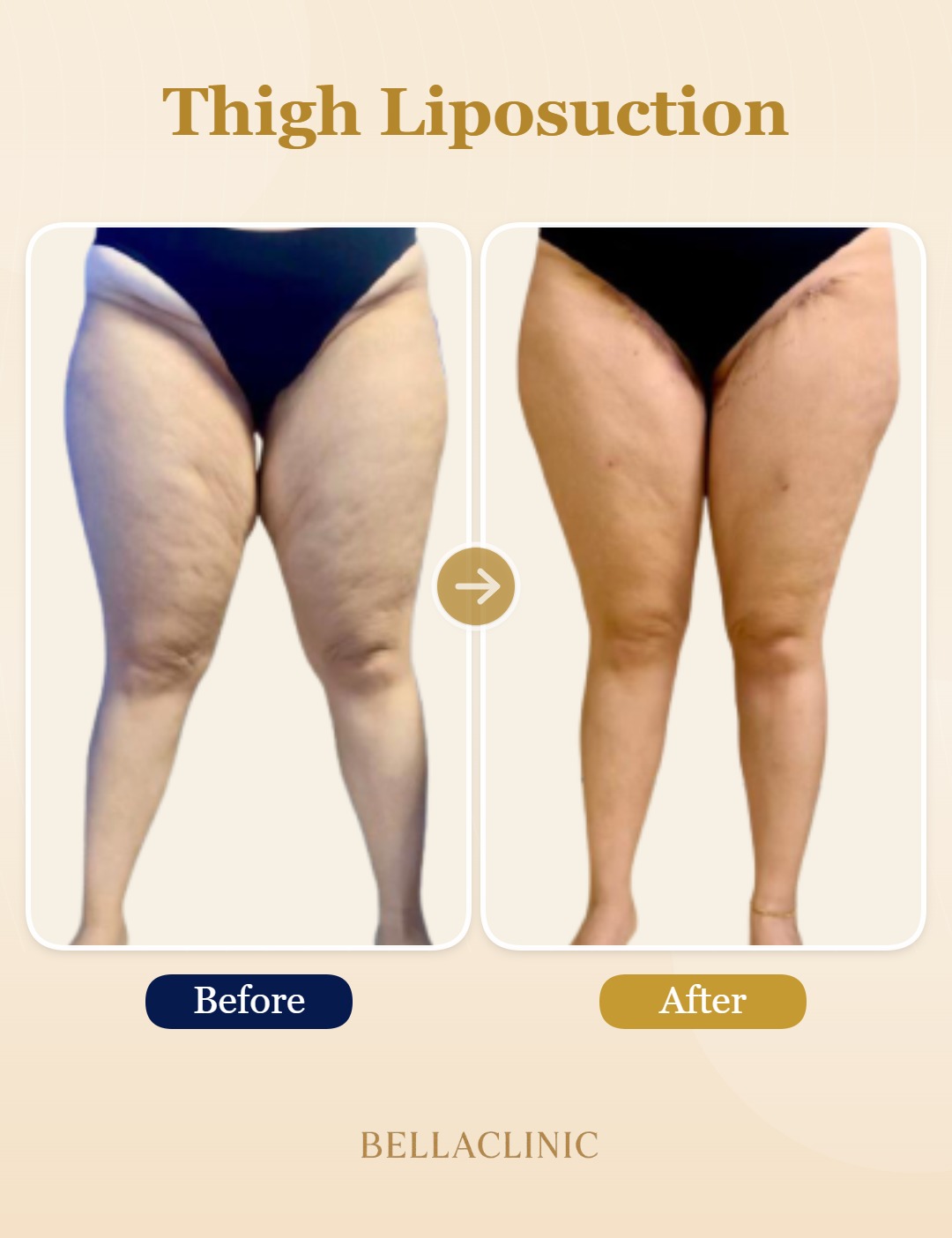 before-after-20260720-173643-cJogSj.jpg
