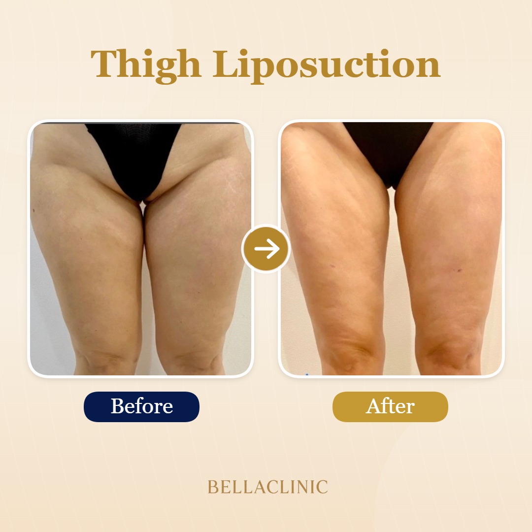 before-after-20260720-173734-rOYaPP.jpg