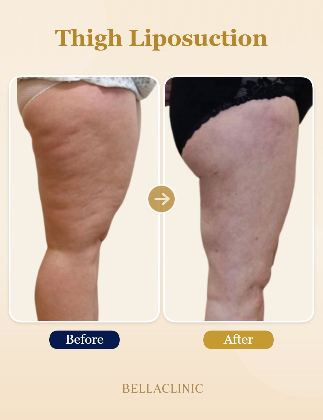 before-after-20260720-174103-BjGP4M.jpg